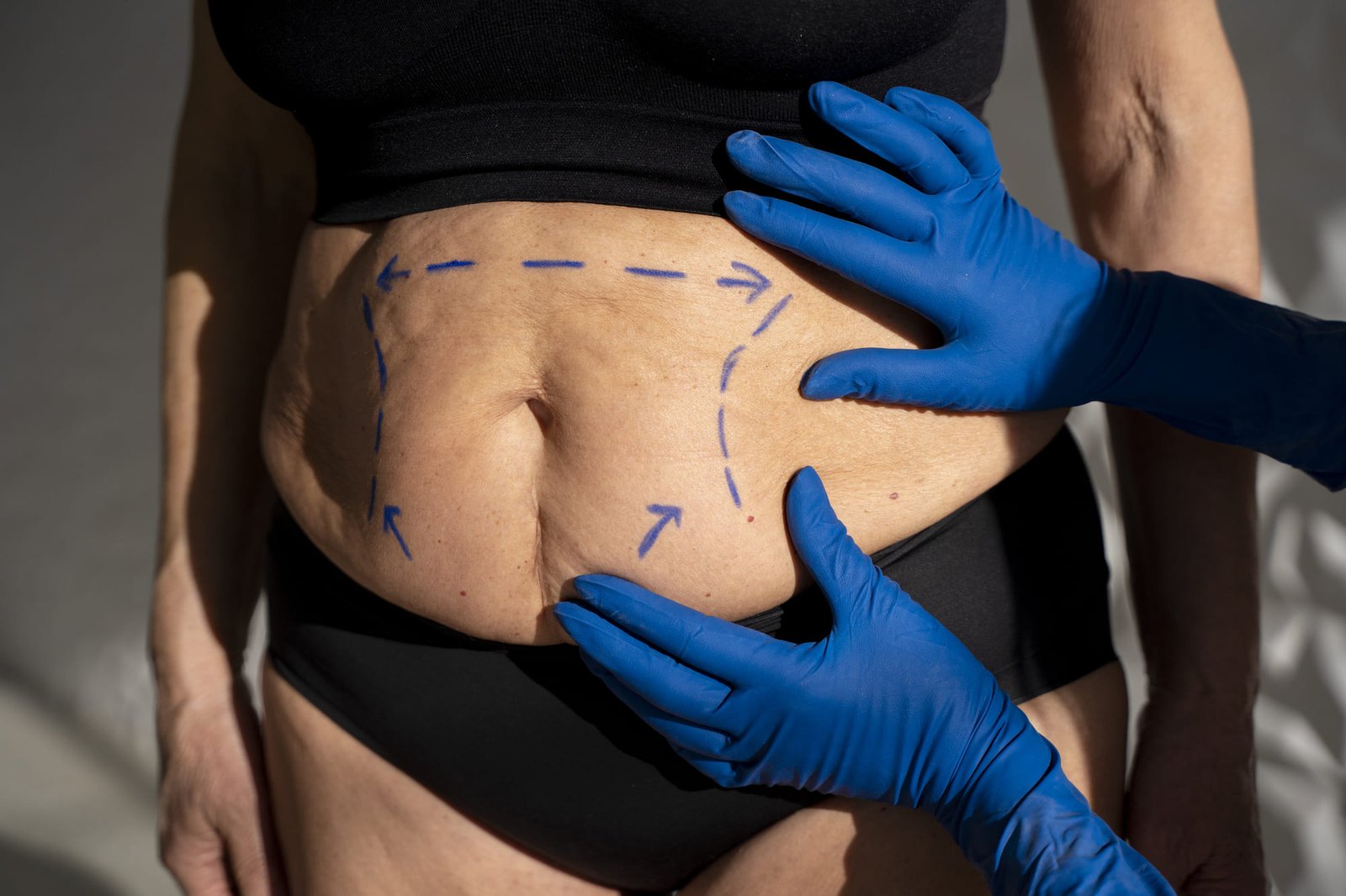 Is Body Contouring Right for You? A Complete Guide